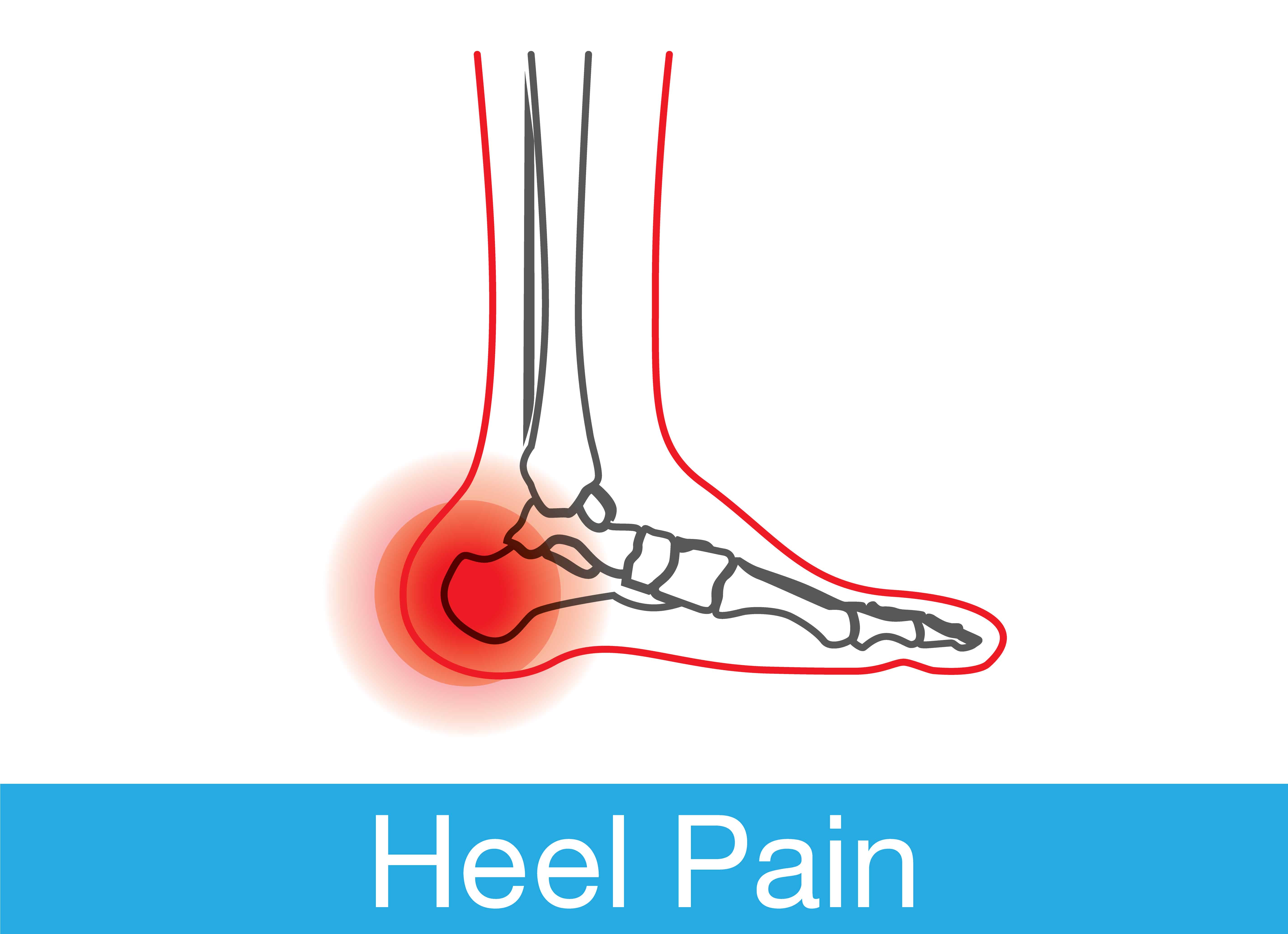 Dr Foot’s favourite treatments for heel pain