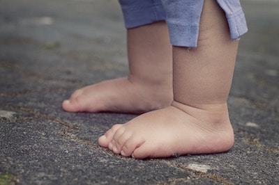 Taking care of common kids’ foot complaints - 1